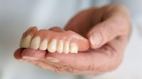 perlu saran dokter untuk menentukan pilihan antara pakai gigi palsu atau implan gigi 95e1732